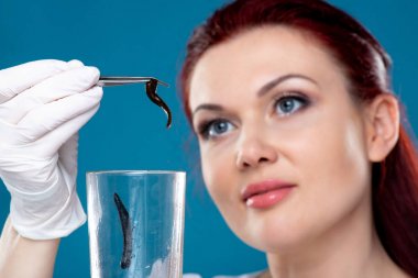 Kadın doktoru tıbbi sülükler cımbız tutar. Hirudotherapy, H