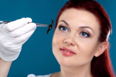 Kadın doktoru tıbbi sülükler cımbız tutar. Hirudotherapy, H