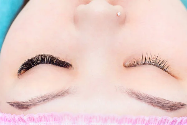 The girl with the increased eyelashes on one eye. Comparison of the increased eyelashes with usual