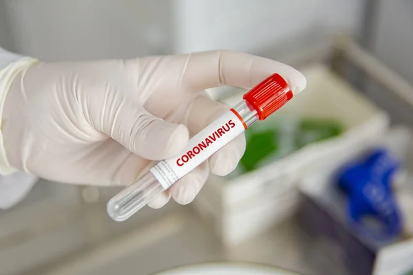 Koronawirus Test Tubki Zbliżenie Pracownik Medyczny Gospodarstwa — Zdjęcie stockowe