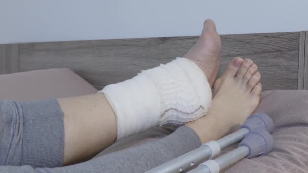 Woman's Injured Broken Leg Close — Stock Video © ilze79 #416473544