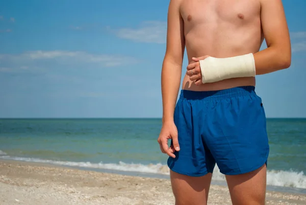 Gypsum fracture on a man\'s hand, sand close-up against the background of the sea and the sky clouds, broken arm limb, illness recovery, the guy in blue shorts, summer sun weekend rest vacation, beach