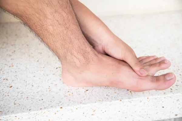 Lesão no pé — Fotografia de Stock