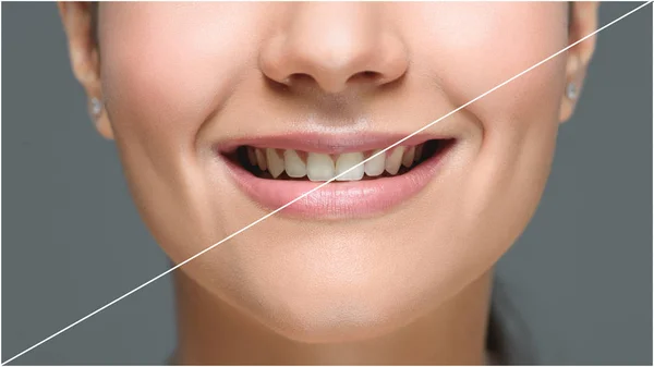 Visão Parcial Mulher Sorridente Com Belos Dentes Brancos Isolados Cinza — Fotografia de Stock