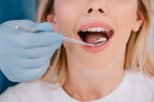 oříznutý pohled vyšetřující zubů zubař mladé ženy s úst zrcadlo