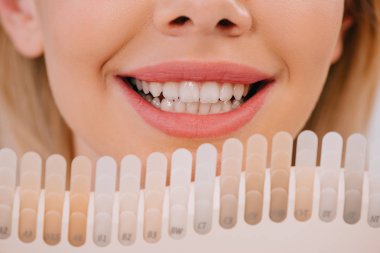 cropped view of smiling woman holding teeth color palette, teeth whitening concept clipart