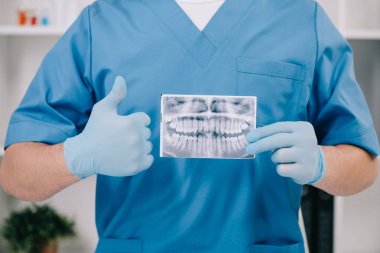 cropped view of orthodontist showing thumb up and holding teeth x-ray in clinic  clipart