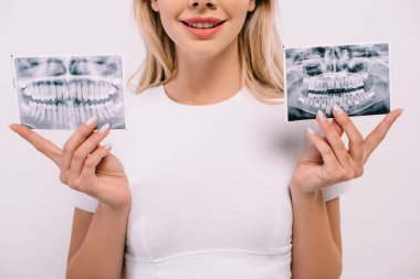 cropped view of smiling woman in t-shirt holding teeth x-rays isolated on white clipart
