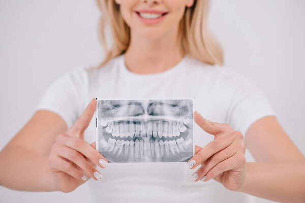 cropped view of woman in t-shirt holding teeth x-ray isolated on white