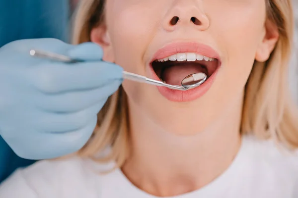 歯科医口ミラーを持つ若い女性の歯の検査のビューをトリミング — ストック写真