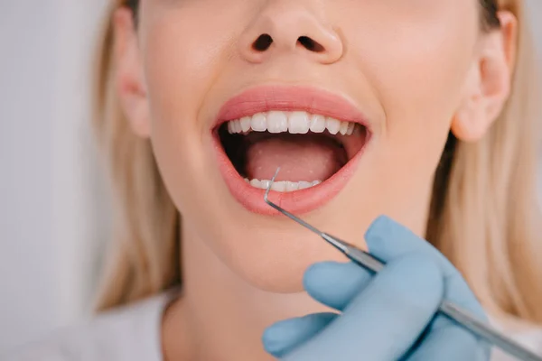 Обрізаний Вид Стоматолога Який Вивчає Зуби Молодої Жінки Стоматологічним Зондом — стокове фото