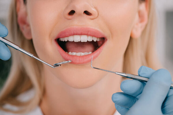 cropped view of dentist examining teeth of young woman with mouth mirror and dental probe