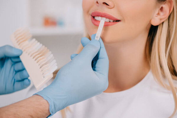 cropped view of male dentist matching teeth color of woman with palette in clinic, teeth whitening concept
