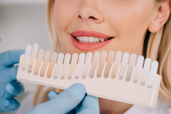 cropped view of male dentist matching teeth color of woman with palette in clinic, teeth whitening concept