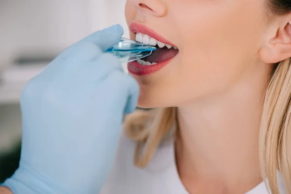 クリニックの予定の中に女性の口の中でトレーナー歯科ブレースを入れてのラテックス手袋で矯正のビューをトリミング — ストック写真
