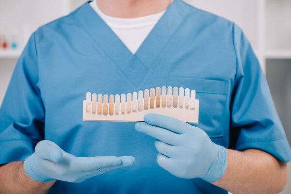 partial view of dentist holding teeth color palette in clinic, teeth whitening concept