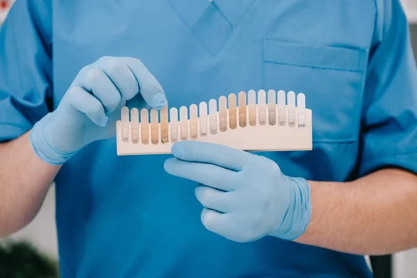 Vista Recortada Del Dentista Que Sostiene Paleta Colores Los Dientes — Foto de Stock