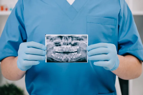 Bijgesneden Weergave Van Orthodontist Houden Tanden Ray Kliniek — Stockfoto