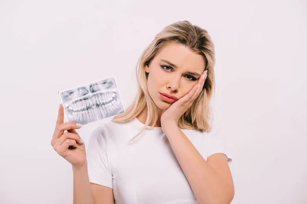 Bela Mulher Shirt Segurando Dentes Raio Tocando Rosto Tendo Dor — Fotografia de Stock