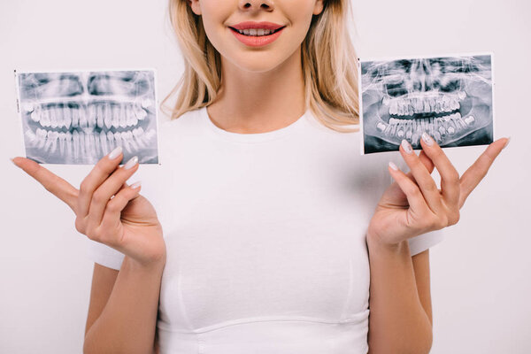 cropped view of smiling woman in t-shirt holding teeth x-rays isolated on white