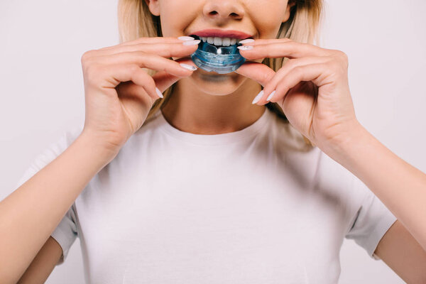 cropped view of woman in white t-shirt putting on orthodontic trainer dental braces isolated on white