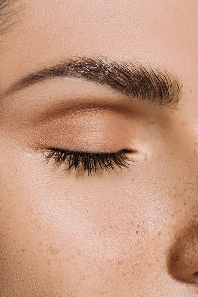 Close View Female Face Freckles — Stock Photo, Image