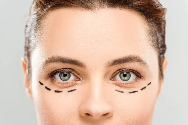 Cropped View Woman Marks Face Isolated Grey — Stock Photo, Image