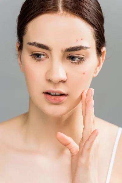 Atraente Jovem Morena Com Acne Tocando Rosto Isolado Cinza — Fotografia de Stock