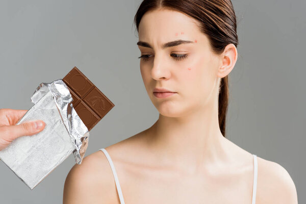 обрезанный вид мужчины, держащего шоколадную плитку рядом с брюнеткой расстроен женщина с акне изолированы на сером
 