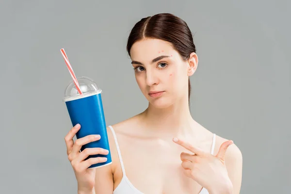 Woman Acne Face Pointing Finger Plastic Cup Straw Isolated Grey — Stock Photo, Image