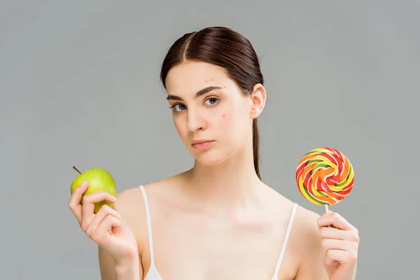 brunette woman with acne on face holding sweet lollipop and green apple isolated on grey