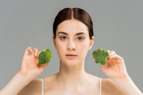 young brunette woman with acne on face holding broccoli isolated on grey 