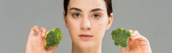 panoramic shot of young brunette woman with acne on face holding green broccoli isolated on grey 