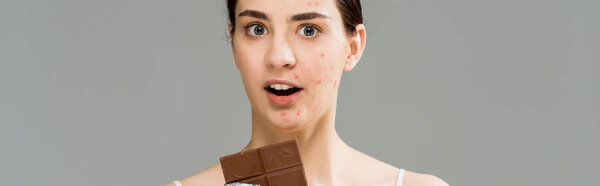 панорамный снимок удивленной брюнетки с прыщами на лице, держащей шоколадку, изолированную на сером
 
