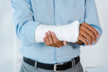cropped view of injured man touching broken arm wrapped in gypsum bandage  clipart