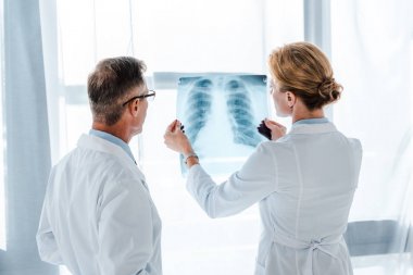 Gözlük Doktor iş arkadaşı elinde x-ray bakıyor 