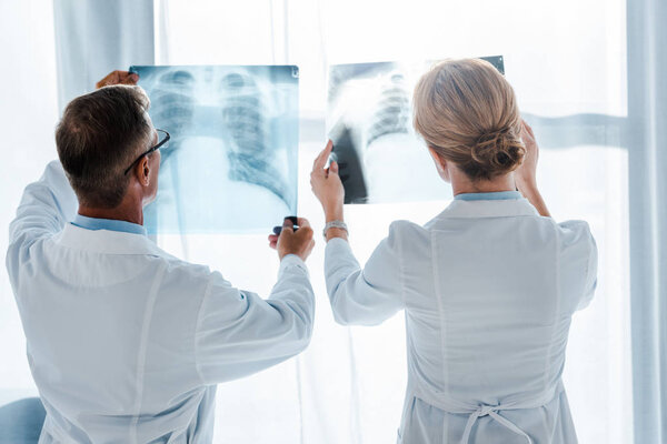 врач в очках и коллега стоит и смотрит на рентгеновские снимки в клинике
 