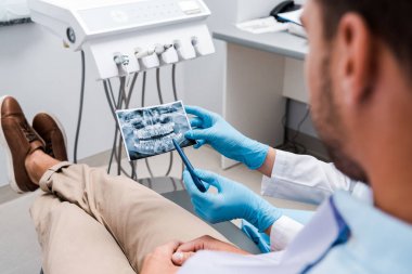 kliniğe x-ray ve hasta yakınında kalem tutan diş hekimi kırpılmış 