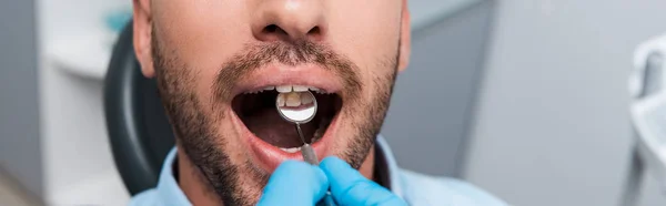 Tiro Panorâmico Dentista Segurando Espelho Dentário Boca Paciente Barbudo — Fotografia de Stock