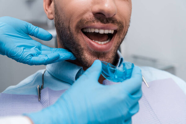 selective focus of dentist holding retainer near patient with opened mouth 