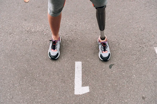 Vista Parziale Sportiva Disabile Con Protesi Strada — Foto Stock