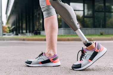 Sokakta protezi olan engelli sporcunun kısmi görüntüsü