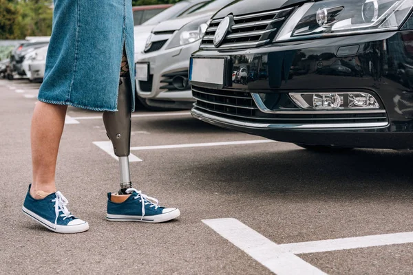 Обрізаний Вид Жінки Інвалідністю Протезною Ногою Вулиці — стокове фото