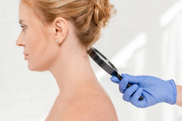 Ostříhaný Pohled Dermatologa Vyšetřujícího Pokožku Pacienta Lupou Klinice — Stock fotografie