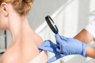 Dermatolojistin klinikte büyüteçle deri incelemesi yapması.