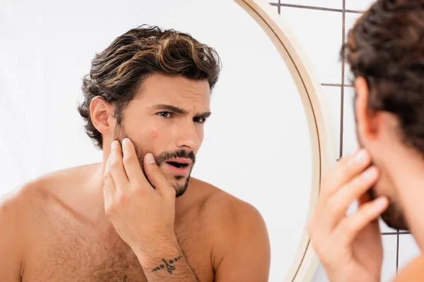 Worried Man Touching Cheek Acne While Looking Mirror Bathroom — Stock Photo, Image