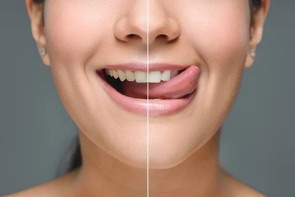 Partial view of smiling woman with white teeth sticking tongue out isolated on grey, teeth whitening concept — Stock Photo