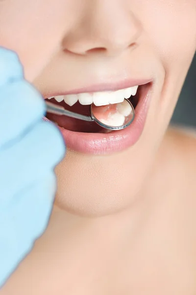 Partial view of dentist with dental mirror checking womans teeth — Stock Photo