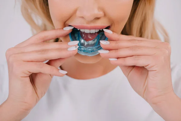 Обрезанный вид женщины, надевающей ортодонтический тренажер зубные скобки изолированы на белом — стоковое фото