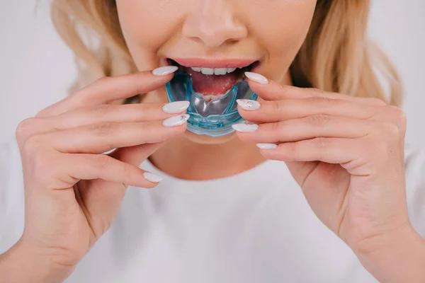Vue partielle de la femme portant un appareil dentaire d'entraînement orthodontique isolé sur blanc — Photo de stock